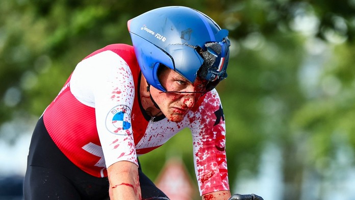 VIDEO: Zlomená ruka, lícna kosť i otras mozgu. Švajčiarsky cyklista zbadal bariéry neskoro