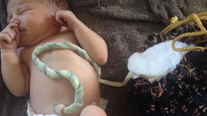 Odborníci varujú pred lotosovým pôrodom. Dieťa je niekoľko dní spojené s placentou