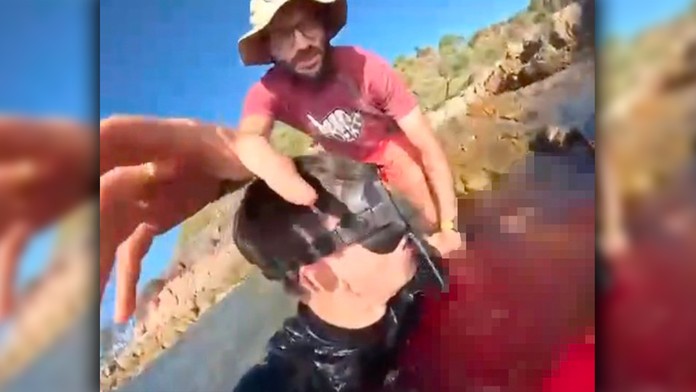 VIDEO: Žralok ho pripravil o nohu. Talian zverejnil desivé zábery a prezradil, ako sa mu podarilo prežiť