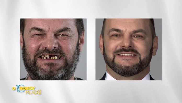 Tomáš pred premenou a po nej