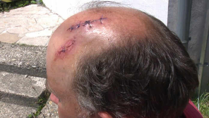 Skupina Rómov napadla rybárov