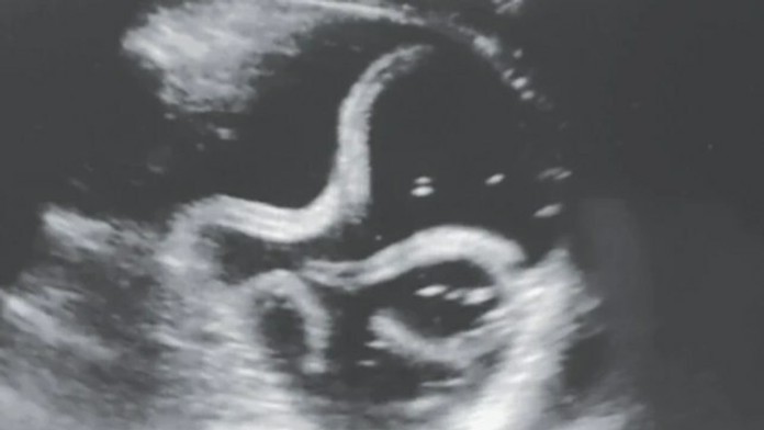 Účastníci tretej série