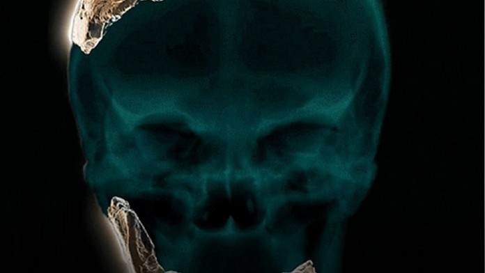 Rekonštrukcia lebky nájdeného človeka.