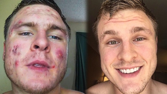 Premena mladého Briana je šokujúca