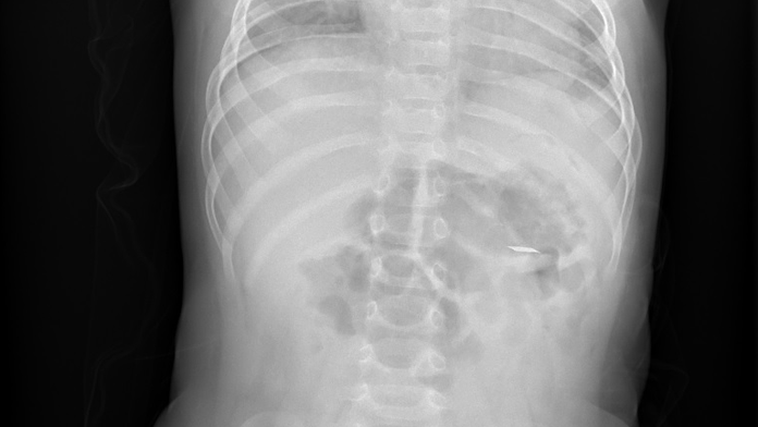 Deti prehĺtajú pliešky