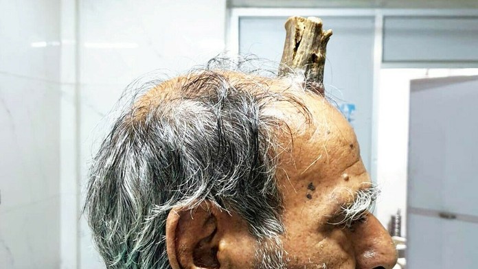 Giovanni Di Lorenzo z Neapola v dueli LM proti Liverpoolu.