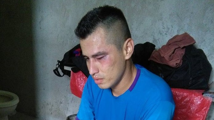 Rozhodca dostal bitku.