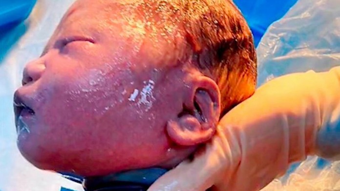 Ľudia počas lesného kúpeľu.