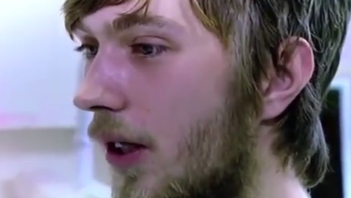 Mladík je otrasným príkladom toho, ako to dopadne, keď si človek neumýva zuby 20 rokov