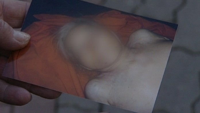 Ženu znetvorila v márnici myš