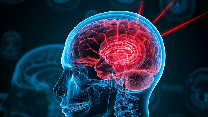 Vedcom sa podarilo vyriešiť hlavný problém liekov na migrénu. Vyvinuli taký, ktorý zaberá okamžite