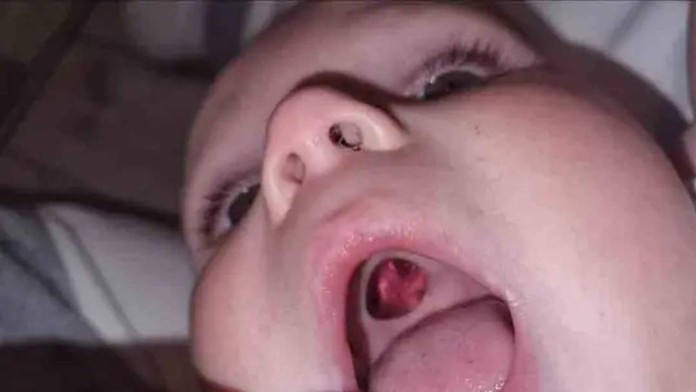 „Diera“ v Harveyho ústach.