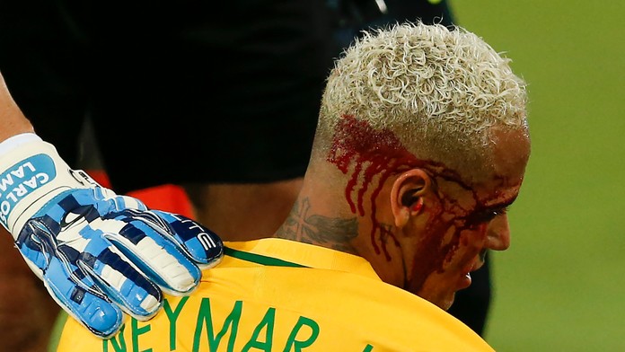 Zranený brazílsky hráč Neymar v 9. kole juhoamerickej kvalifikácie o postup na futbalové MS 2018 proti Bolívii.