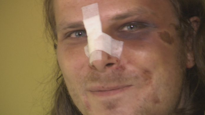 Štefan po zásahu policajtov