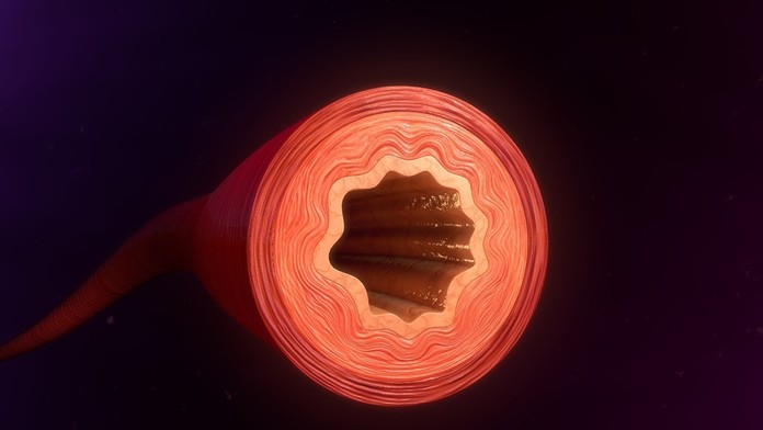 Cennet: 45. epizóda