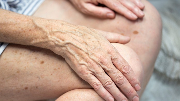 Hmla nad traťou ženskej super-G na majstrovstvách sveta v alpskom lyžovaní v talianskom stredisku Cortina d'Ampezzo.