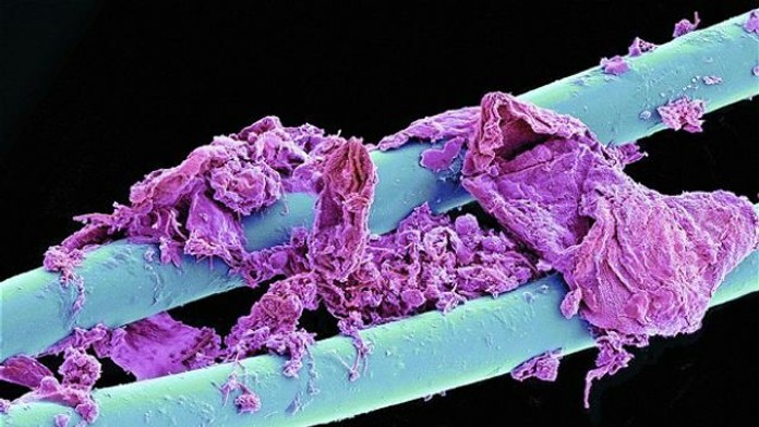 Použitá zubná niť