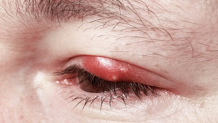 Nikdy nechoďte spať bez odlíčenia. Odborníčka varuje pred následkami na zdraví