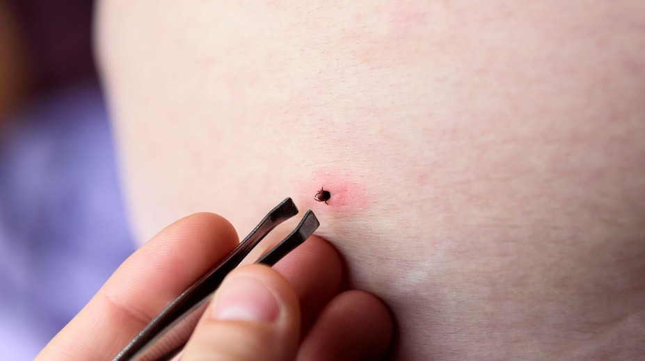 Robíte to takto? Odborníčka vysvetlila, ako správne vyberať kliešte