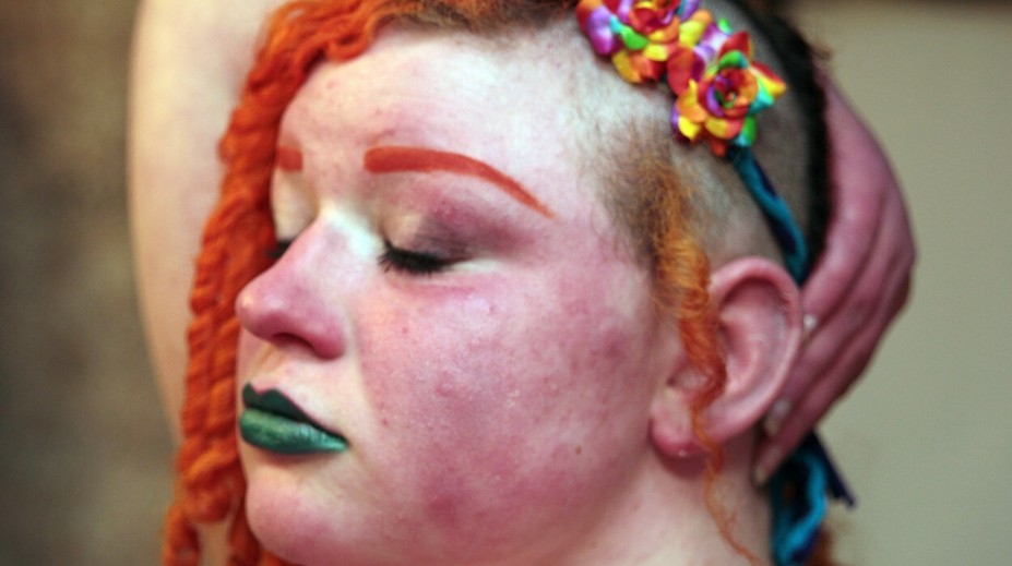 Žena trpí neuveriteľnými bolesťami. Horí zvnútra