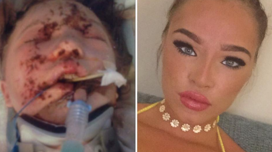 Po vážnej autonehode sa jej vysmievali. Dnes vyzerá úžasne