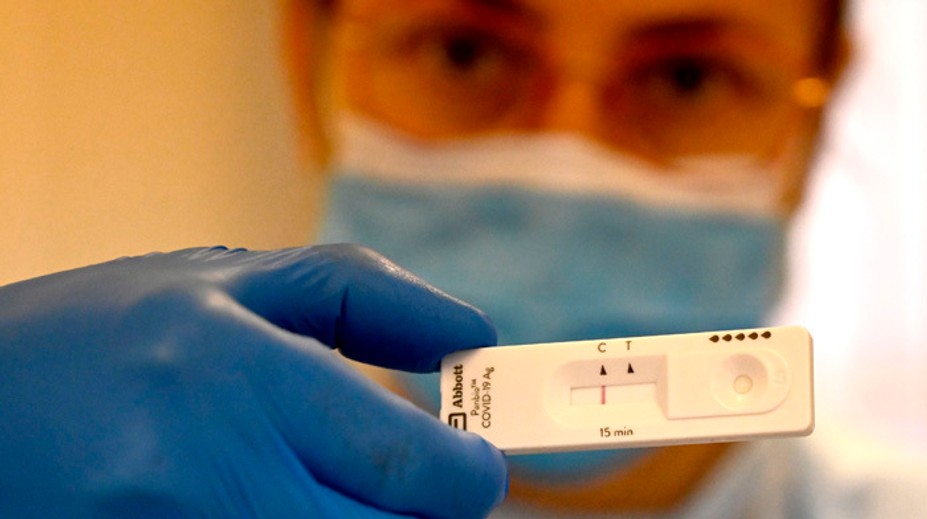 NCZI zverejnilo, ktoré vekové kategórie majú najčastejšie pozitívny výsledok PCR testu