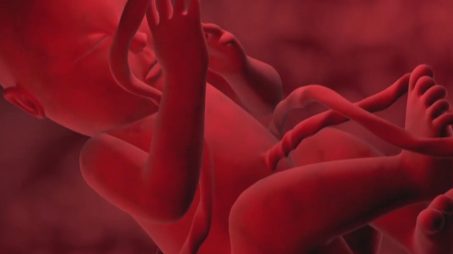 Matka má tri možnosti, ako naložiť s pupočníkovou krvou po pôrode. Čo odporúčajú odborníci?