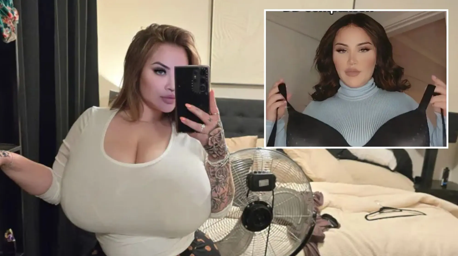 Austrálčanka trpí vzácnou poruchou. Prsia jej začali nekontrolovateľne rásť, keď mala 25 rokov