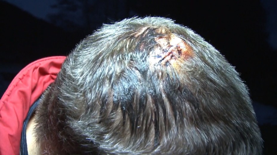 Streľba v depe v Plešivci. Železničiar na túto obchôdzku nikdy nezabudne