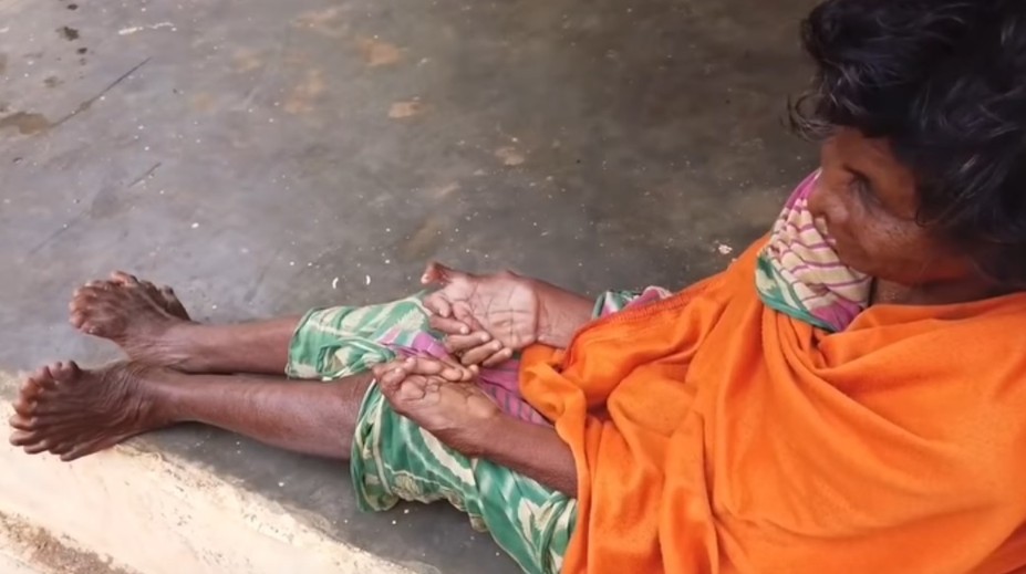 Žena trpí vzácnou anomáliou. Nadmerný počet prstov z nej robí rekordérku