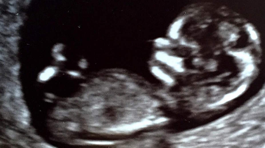 Žiari šťastím. Po dvoch adopciách nosí herečka pod srdcom dieťa