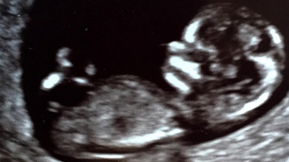 Žiari šťastím. Po dvoch adopciách nosí herečka pod srdcom dieťa