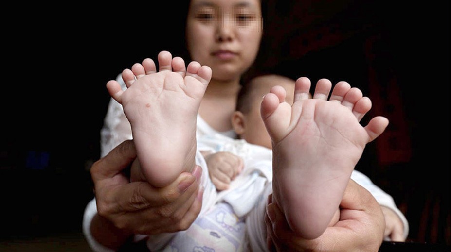V Číne sa narodil chlapec, ktorý je iný ako ostatní