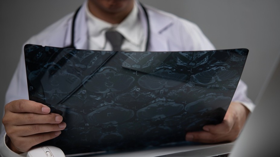 Mŕtvica je pravdepodobnejšia u ľudí s jednou krvnou skupinou. Vedci odhaľujú prekvapivé súvislosti