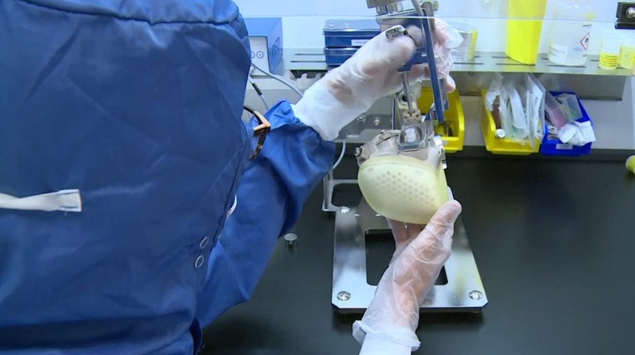 Pomôže zachrániť životy státisícom ľudí. Francúzi vyvinuli kompletne umelé srdce