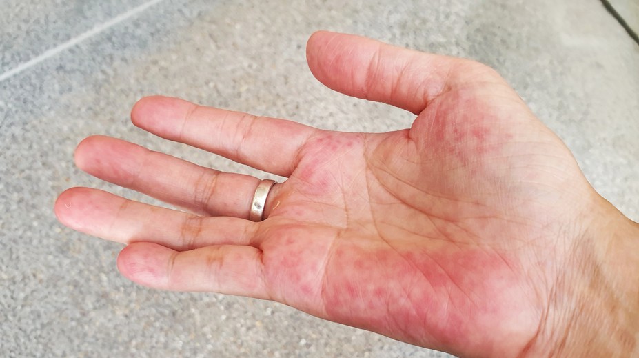 Únava nemusí prísť len s jesenným počasím. Tichého zabijaka indikujú viaceré príznaky