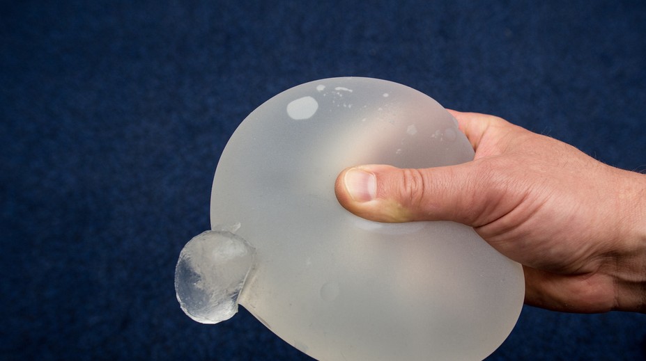 Žene zachránil život silikónový implantát, ktorý odklonil projektil mieriaci do srdca