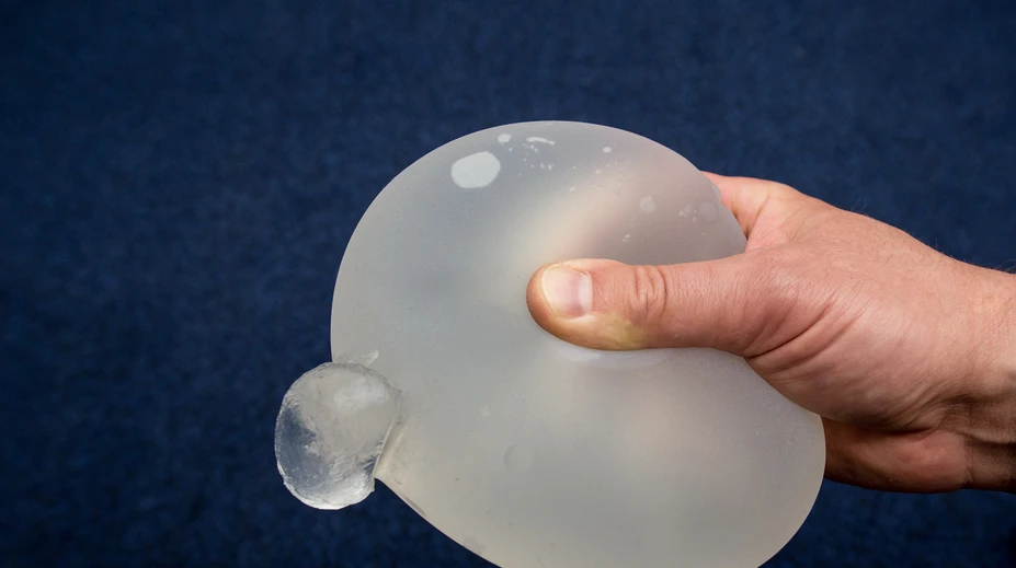 Žene zachránil život silikónový implantát, ktorý odklonil projektil mieriaci do srdca