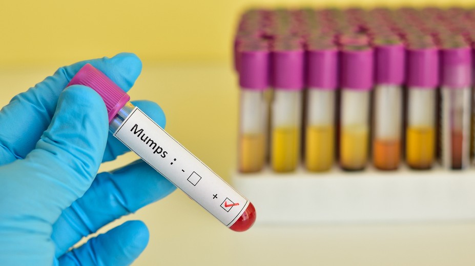 V Bratislavskom kraji zaznamenali jeden prípad nebezpečného ochorenia