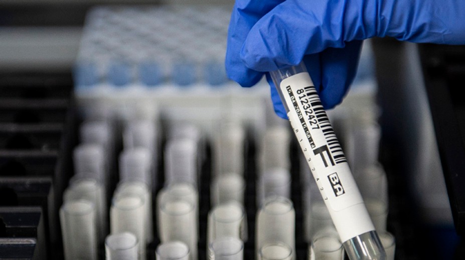 Rýchlotesty, ktoré vláda Igora Matoviča odmietla, ide teraz kúpiť. O euro na kus drahšie