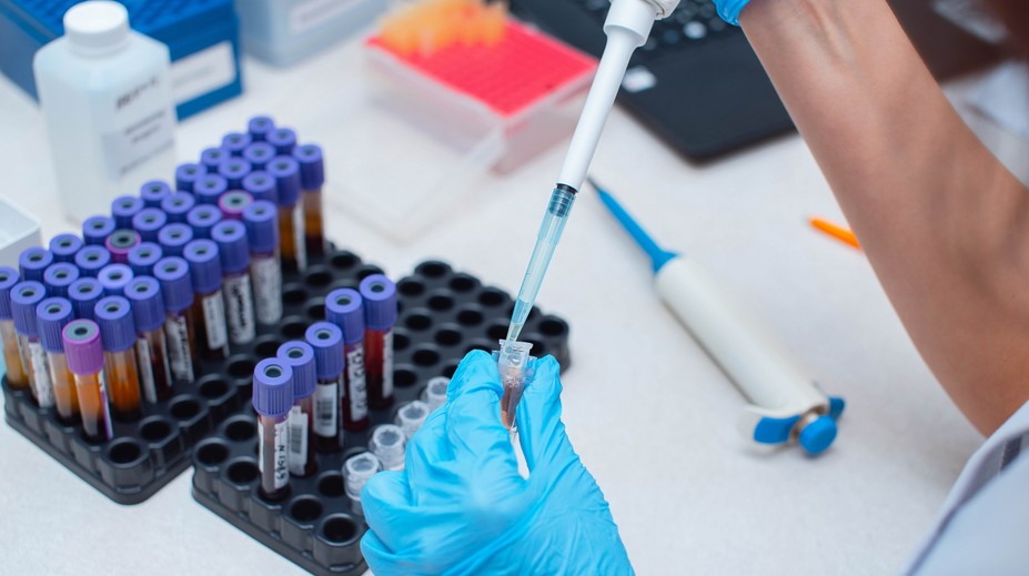 Prelomový liek na HIV je objavom minulého roka. Vírus však stále nedokáže vyliečiť