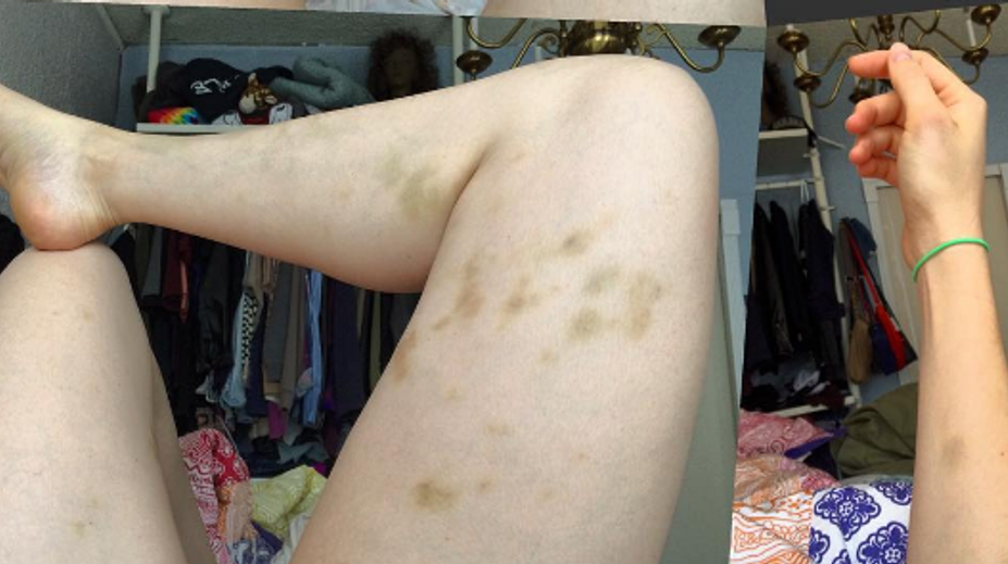 Známa komička odhalila ničivé tajomstvo. S tyranom žila niekoľko mesiacov