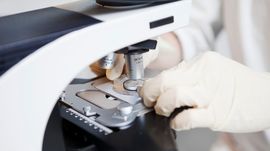 Holandské spermobanky porušovali pravidlá. Desiatky darcov sú otcami aspoň 25 detí, môže ísť o problém