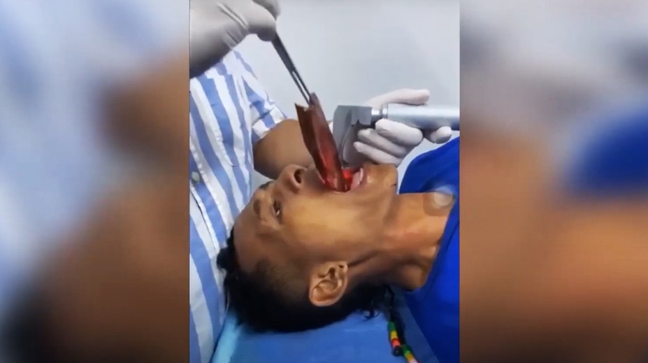 VIDEO: Rybár si chcel v ústach zachytiť rybu. Po tom, ako mu skĺzla do hrdla, skončil v nemocnici