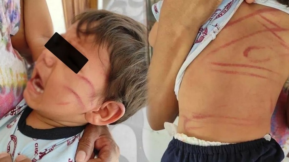 Snímky chlapca (2) lámu srdce. Žena ho mala zbiť, lebo jej poškodil kartu a puzdro na mobil