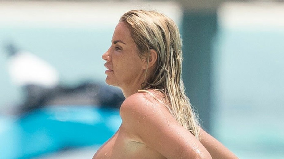 Osem operácií poprsia urobilo svoje. Modelka jazvy neskryje