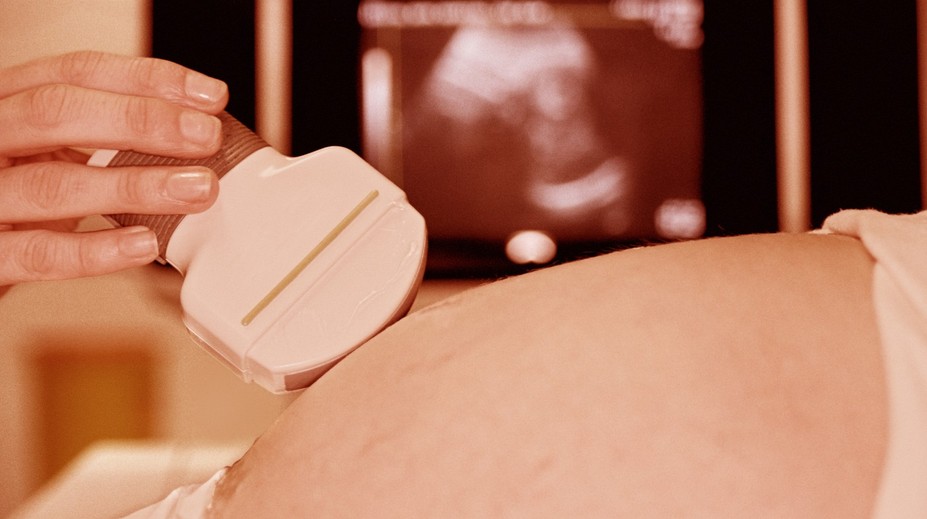 Starostlivosť o tehotné ženy je u nás špičková, hovorí odborník. Garancia dokonalého pôrodu však nie je a nikdy nebude