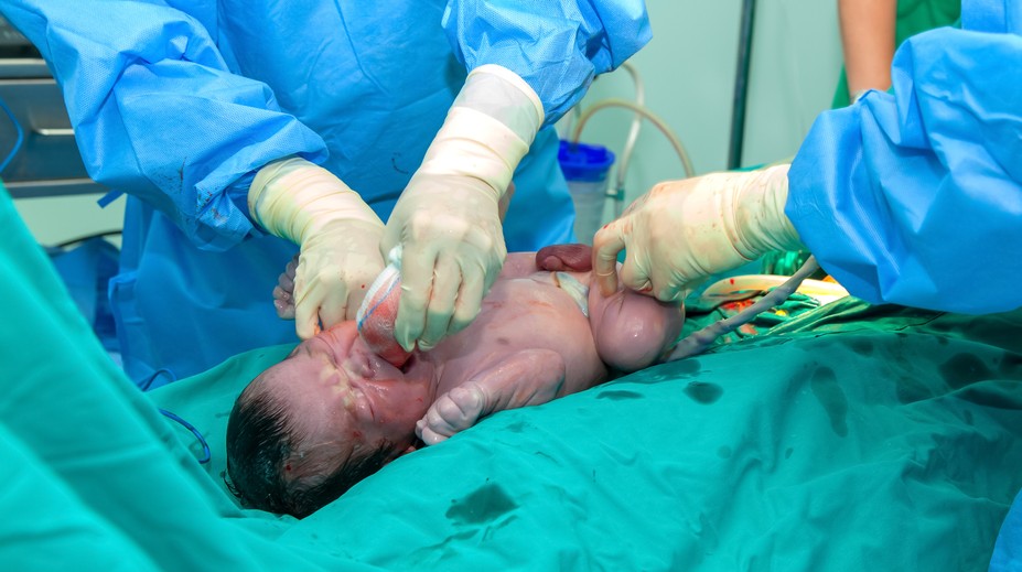 Slovenka Denisa predčasne porodila počas koronavírusu. Jej skúsenosť zaujala zahraničie