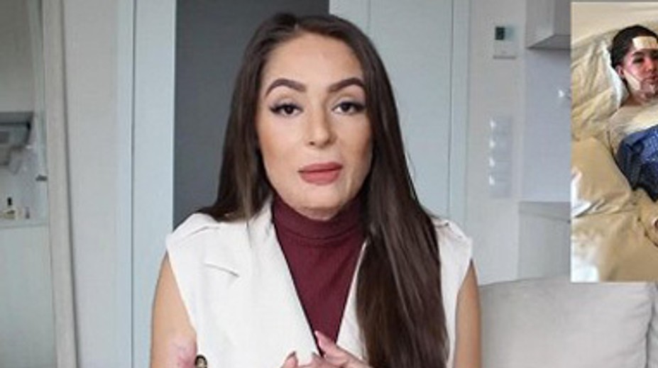 Popálená česká YouTuberka sa odhodlala: Ukázala fotku tesne po nehode