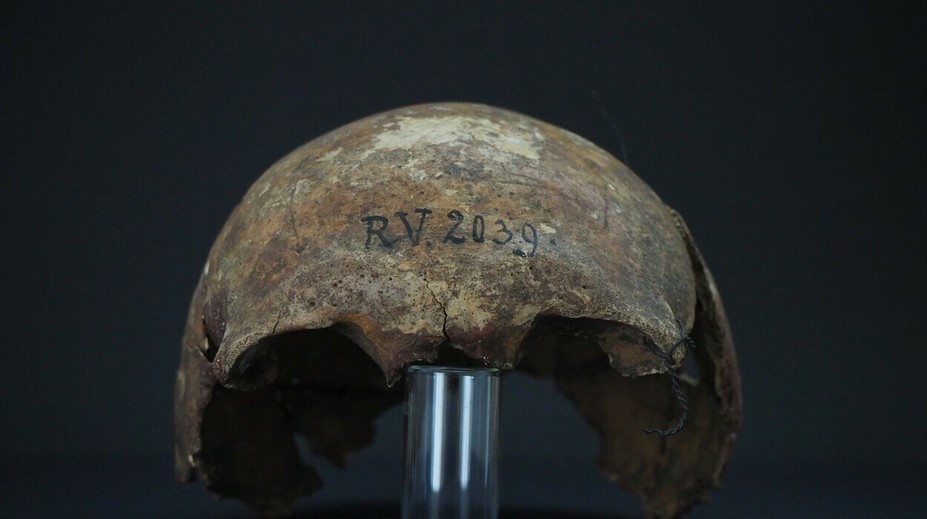 Nový objav vedcov prekvapil: Našli prvú známu obeť moru